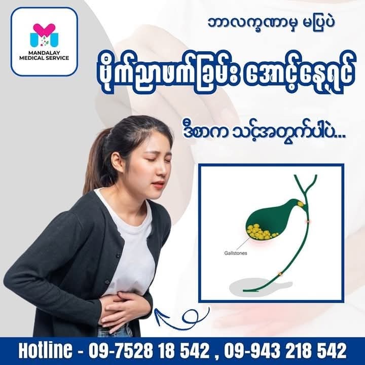 ဘာလက္ခဏာမှ မပြပဲ ဝမ်းဗိုက်ညာဖက်ခြမ်း အောင့်နေရင် ဒီစာက သင့်အတွက်ပါပဲ